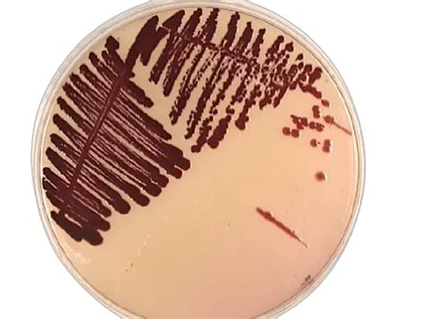 serratia marcescens pronunciation|Serratia marcescens: Properties, Pathogenesis, Diagnosis.